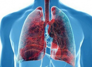 Đừng bỏ qua 10 dấu hiệu cảnh báo bệnh ung thư phổi dưới đây